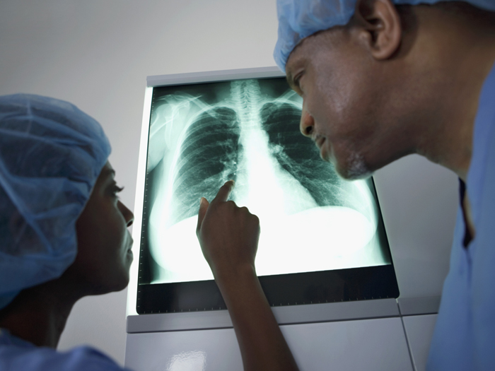 Lung Xray