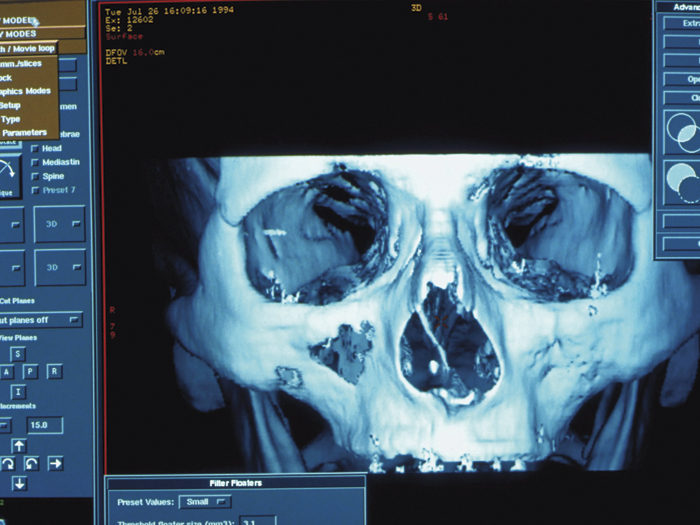 042014_02c_healthcare